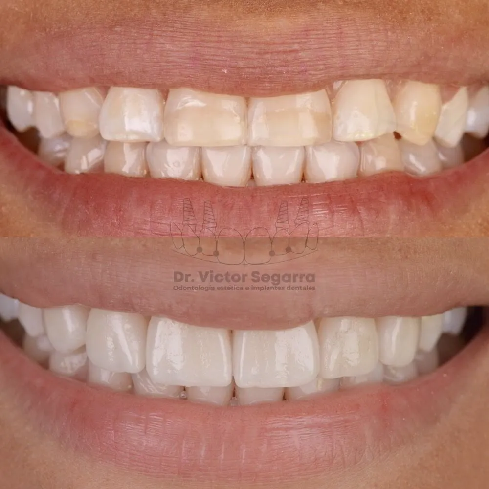 Odontología General Dr. Víctor Segarra