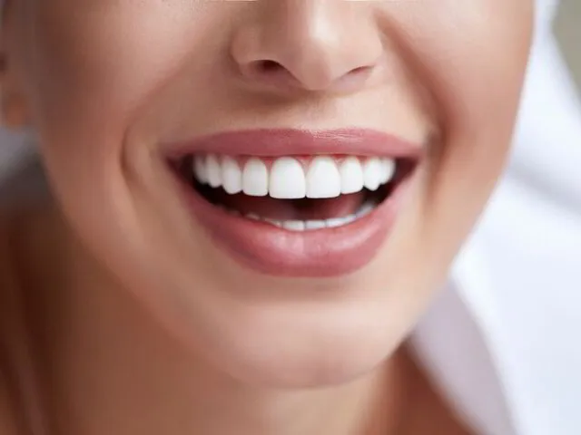 Sonrisa radiante